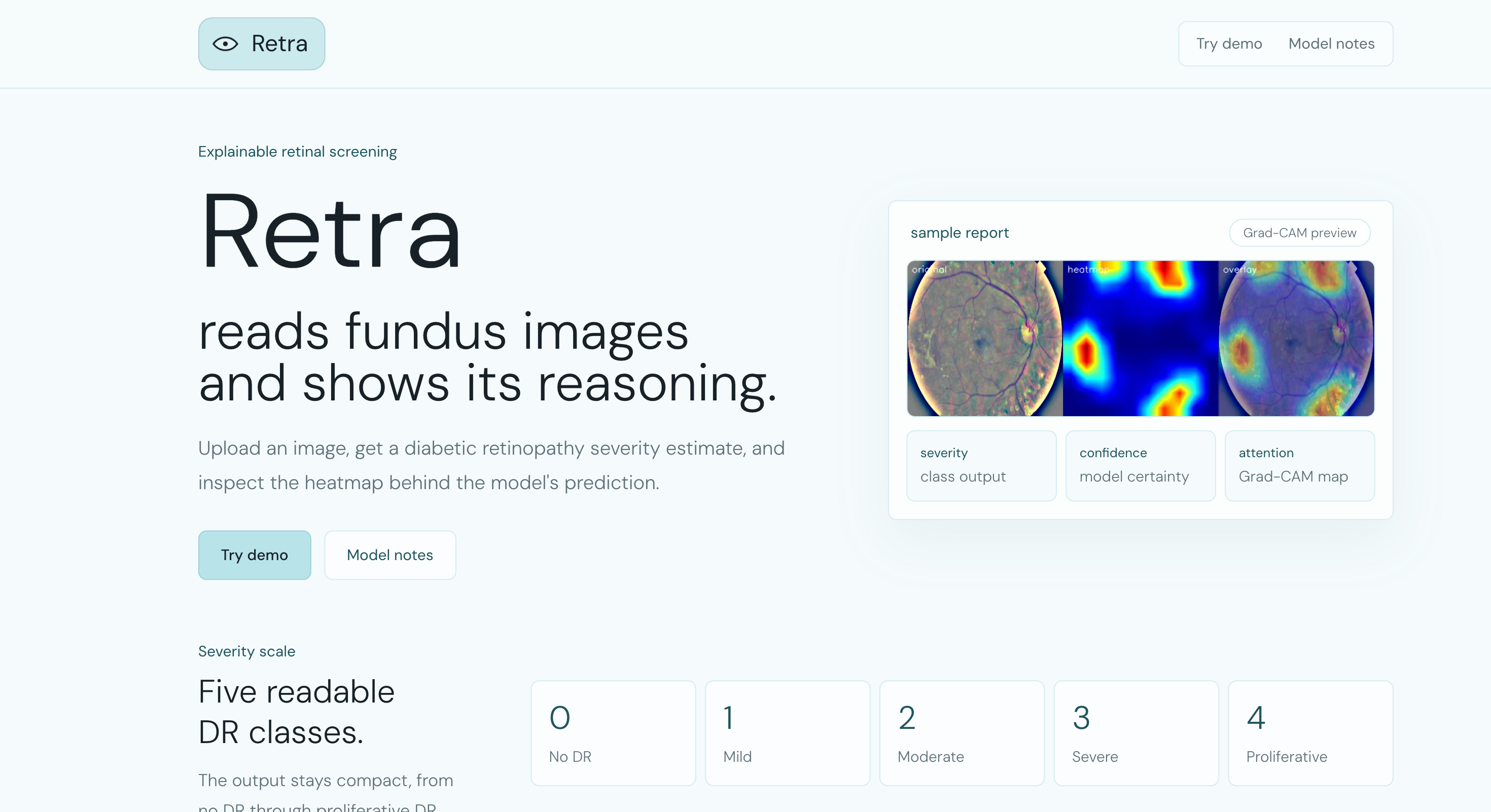 Retra displaying a screening report with a Grad-CAM heatmap
